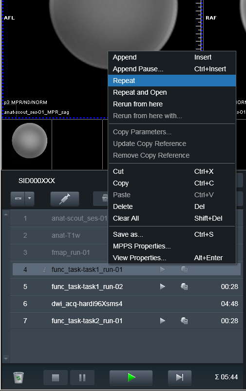wt1-e.1-scan-interrupt-repeat.png